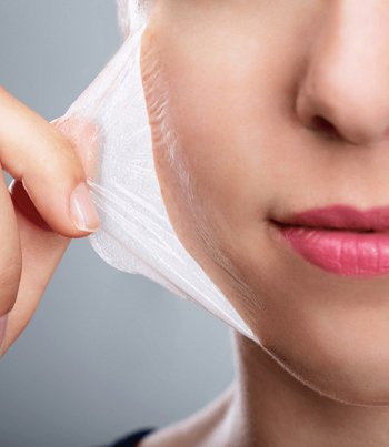 Chemical peel