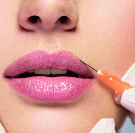 Fillers