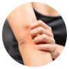 itching
