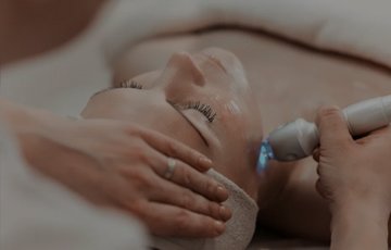 Laser Treatment