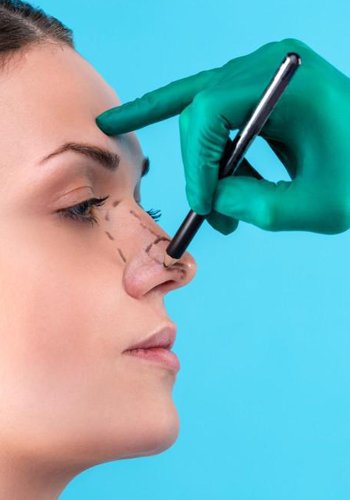 Rhinoplasty